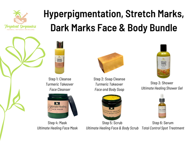 Hyperpigmentation, Stretch Marks and Dark Marks Bundle Deal